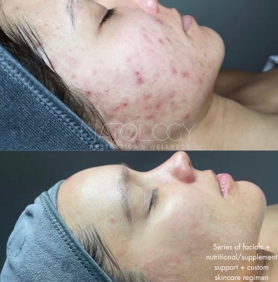 Combination therapy 7