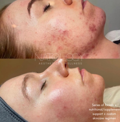 Combination therapy 8