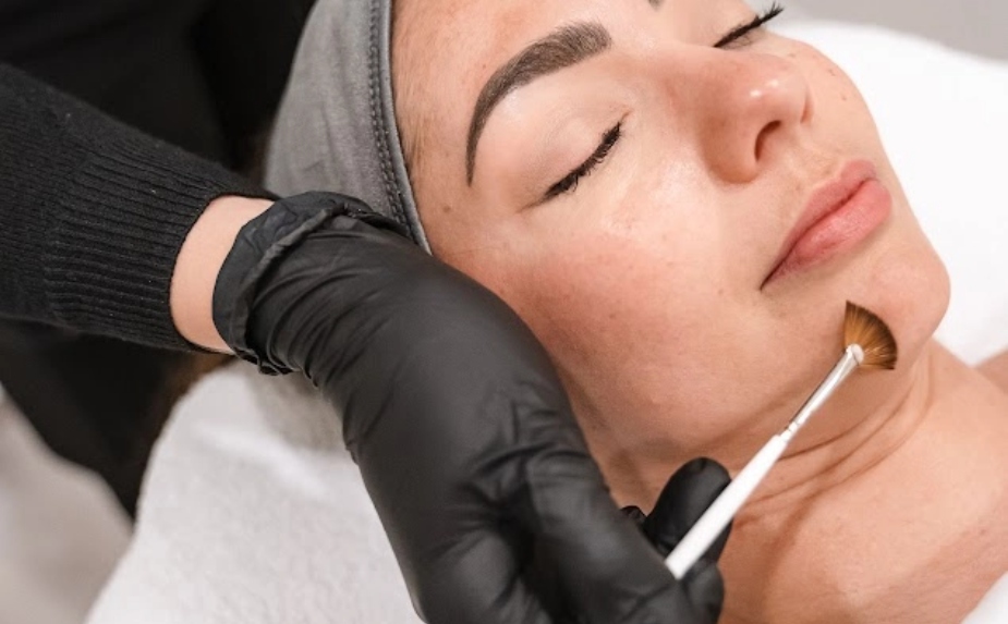 Woman chemical peel clinic