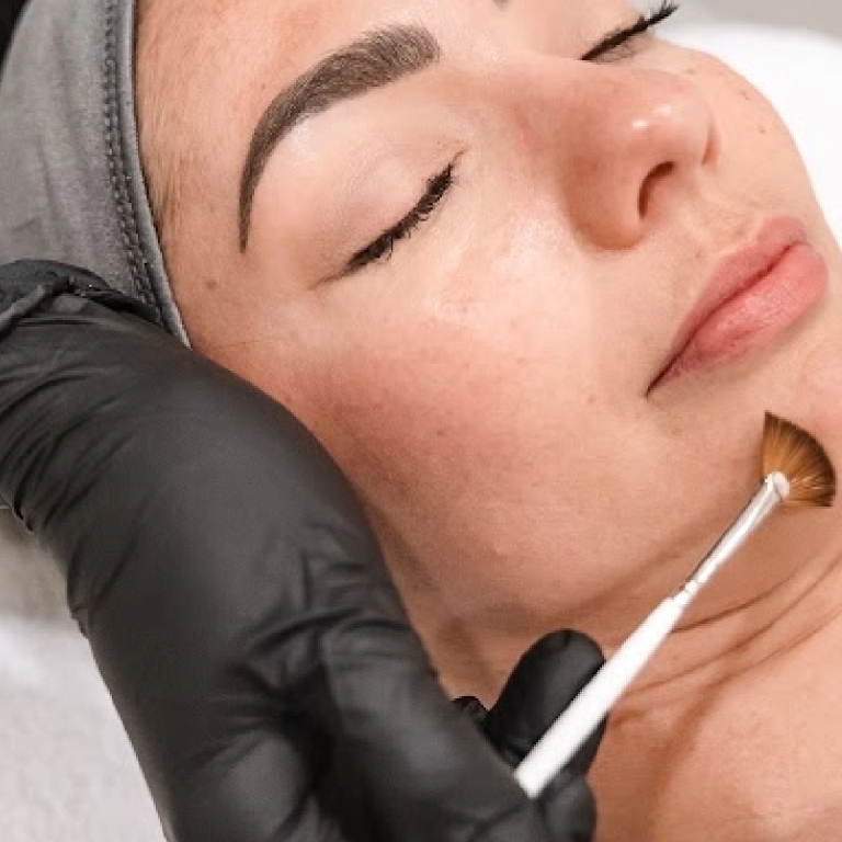 Woman doing chemical peel treatment