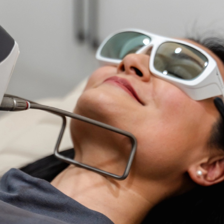 Woman doing laser treatment and wearing white glasses