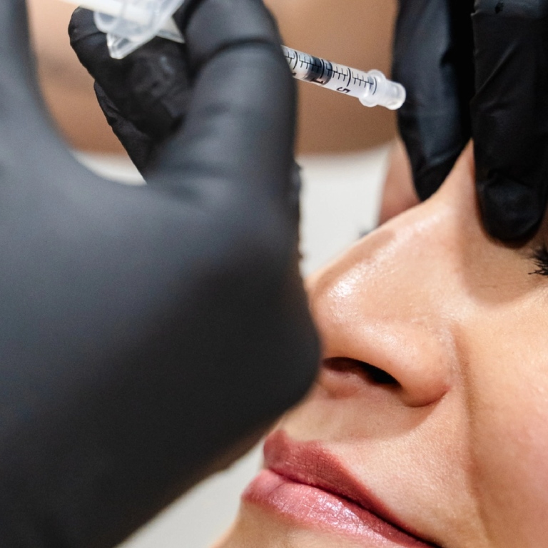 Woman doing prf rejuvenation natology