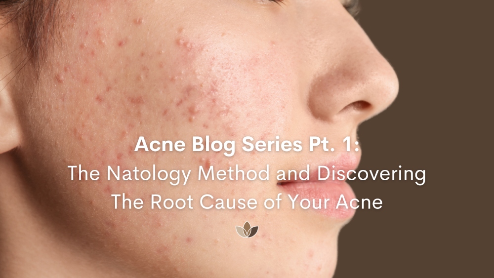 Acne blog
