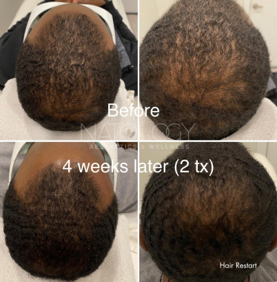 Man hair treatment