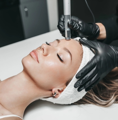 Microneedling service natology