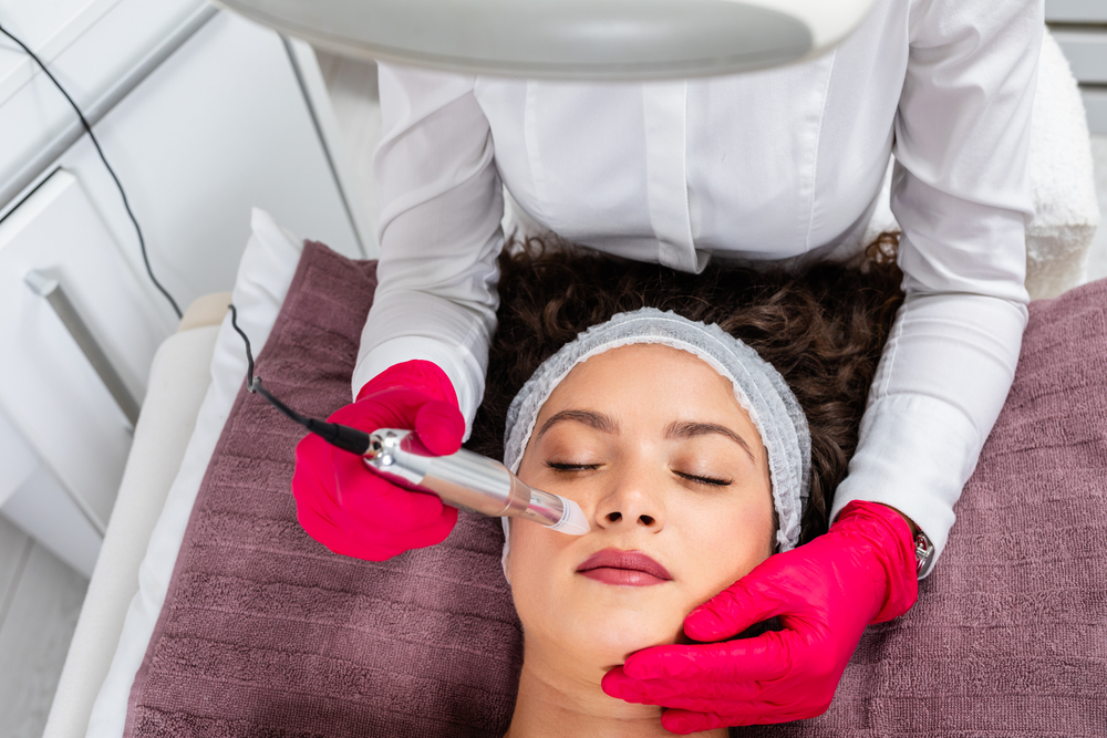 Why winter is the perfect time for microneedling in calgary
