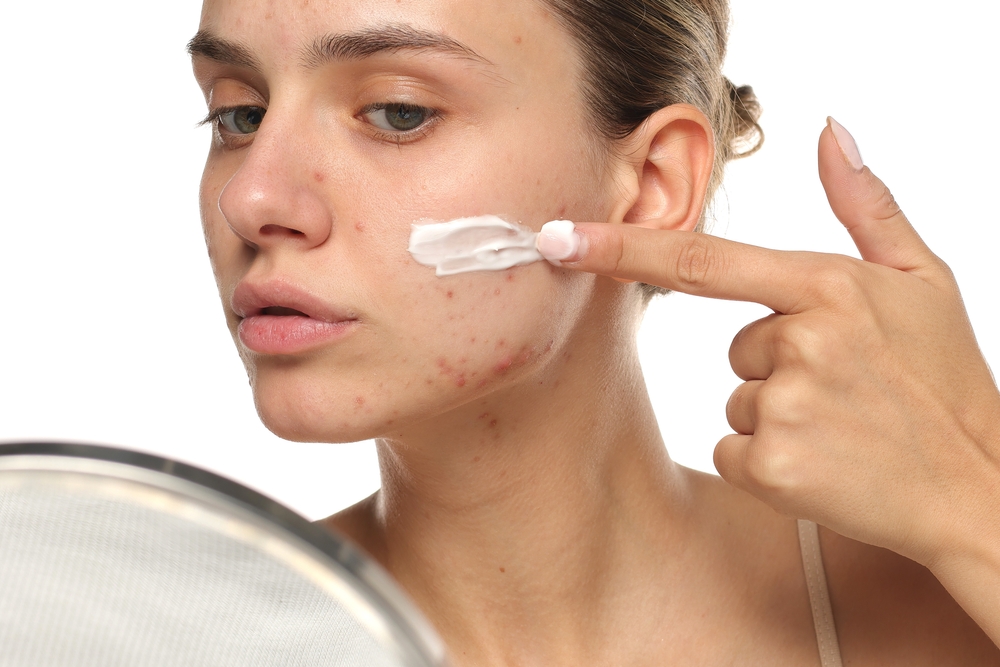 Acne awareness month