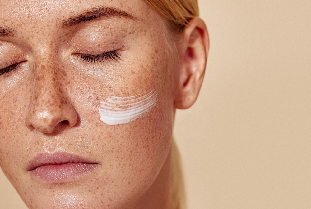 Chemical Peels for Hyperpigmentation